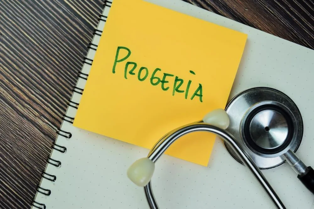 Progeria: cauze, simptome, tratament