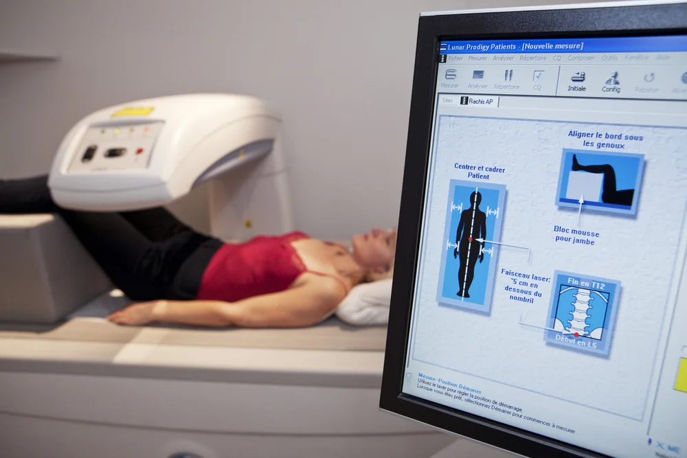 tratament osteoporoza tratament osteoporoza