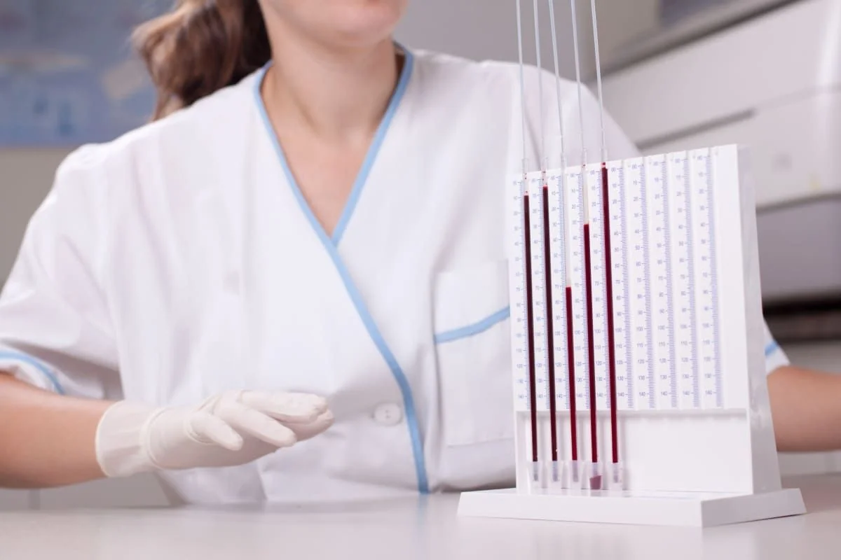 Alimente care scad VSH: lista, indicatii, contraindicatii
