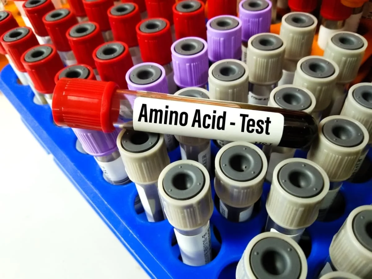 Analiza aminoacizilor in plasma: cand se recomanda si ce pot indica valorile modificate