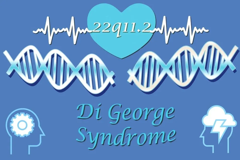 Sindromul DiGeorge: cauze, simptome, tratament