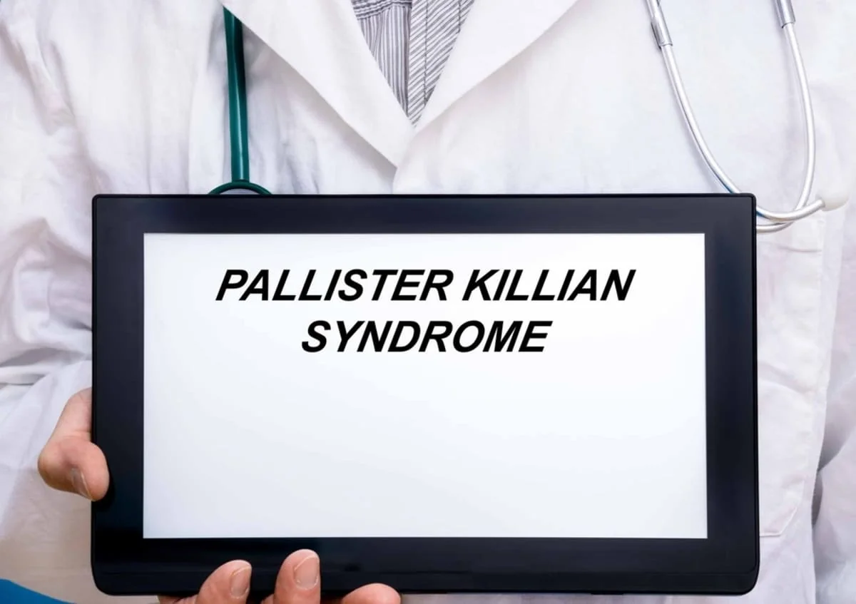 Sindromul Pallister-Killian: cauze, simptome si optiuni de tratament
