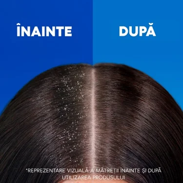 Comparatie inainte si dupa utilizarea samponului Head & Shoulders, evidentiind reducerea vizibila a matretii.