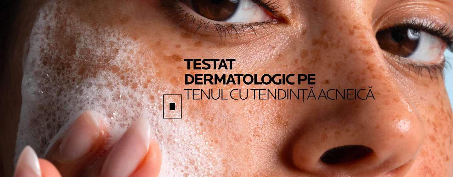 Testat dermatologic pe tenul cu tendinta acneica