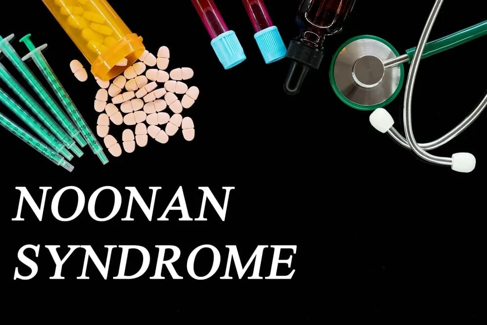 Sindromul Noonan