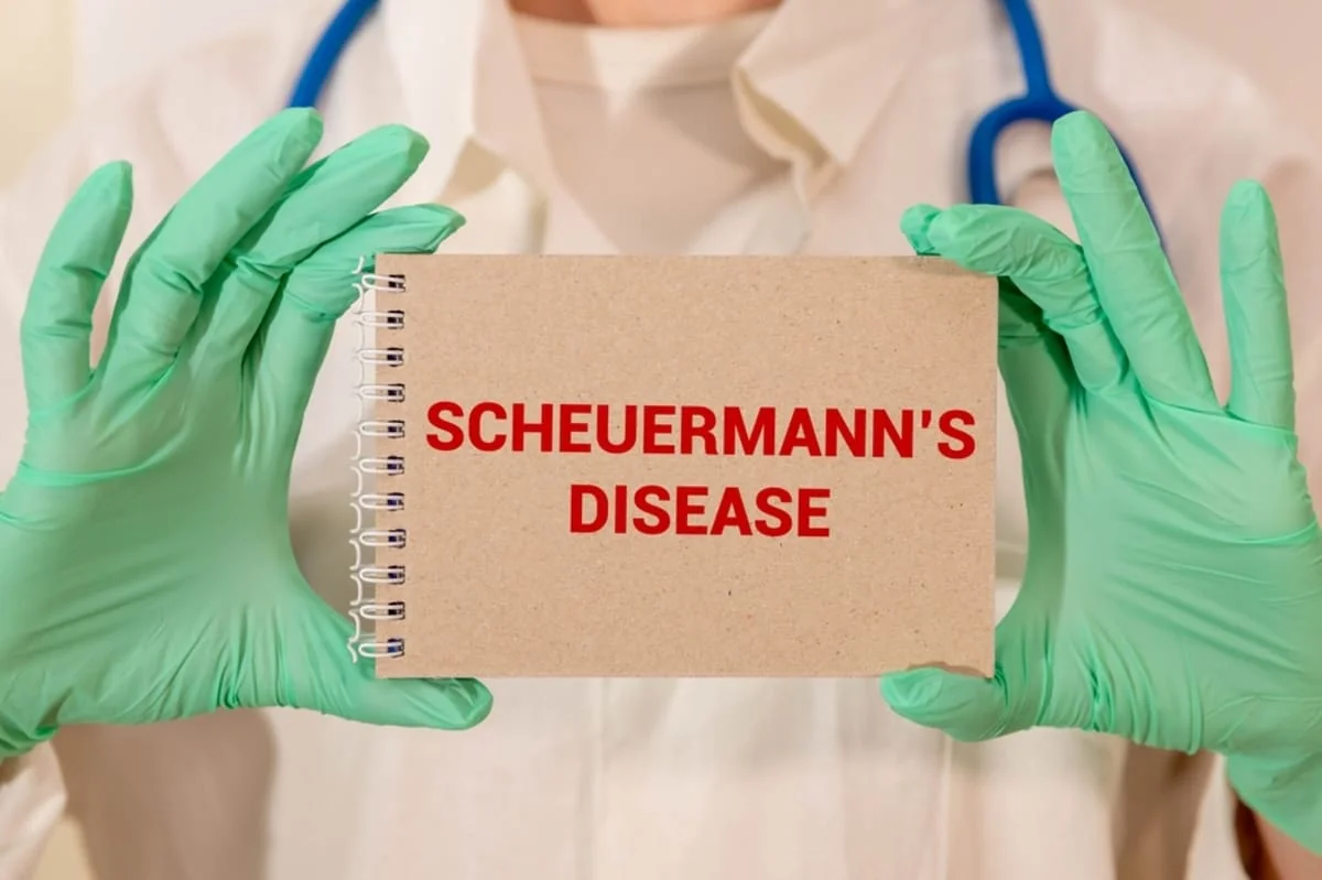 Boala Scheuermann: cauze, simptome si tratament